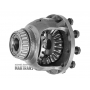 Differential [2WD] without helical gear Hyundai / KIA A5HF1  [10 mounting bolts, 28 slplines, total height 148 mm]