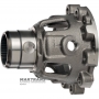 A8LF1 4WD Differential Housing - 458224G150, 458214G100 (10 Helical Gear Mounting Holes)